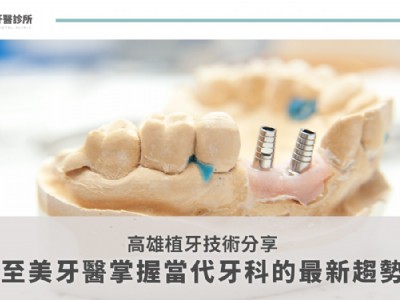 高雄植牙技術分享：至美牙醫掌握當代牙科的最新趨勢