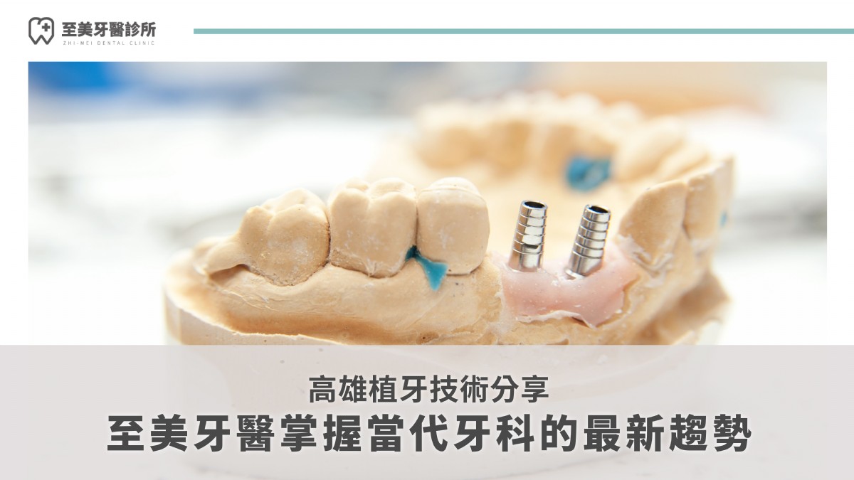 高雄植牙技術分享：至美牙醫掌握當代牙科的最新趨勢